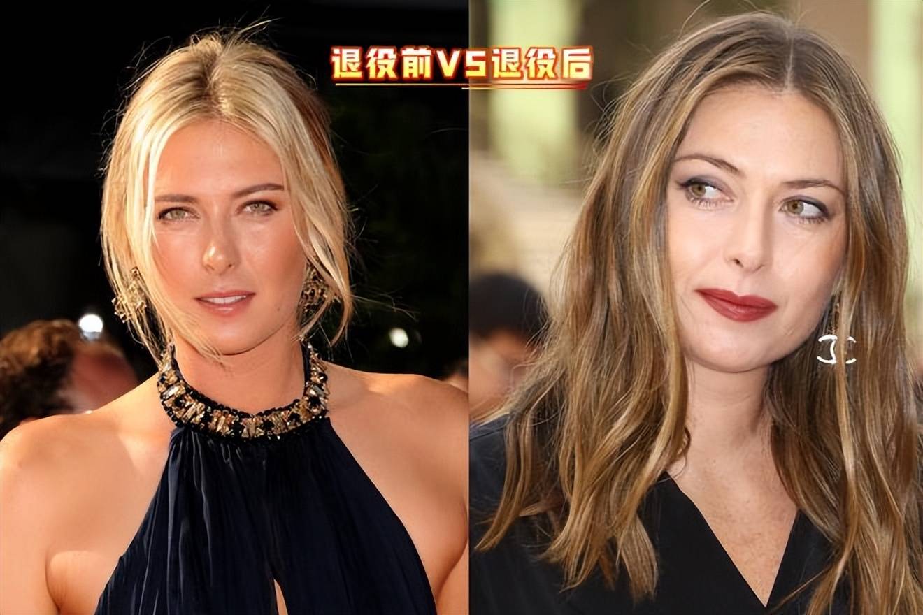 黑白直播-Ming焦点对战，莎拉波娃与70激战湖人分钟，重返赛场胜负难料！